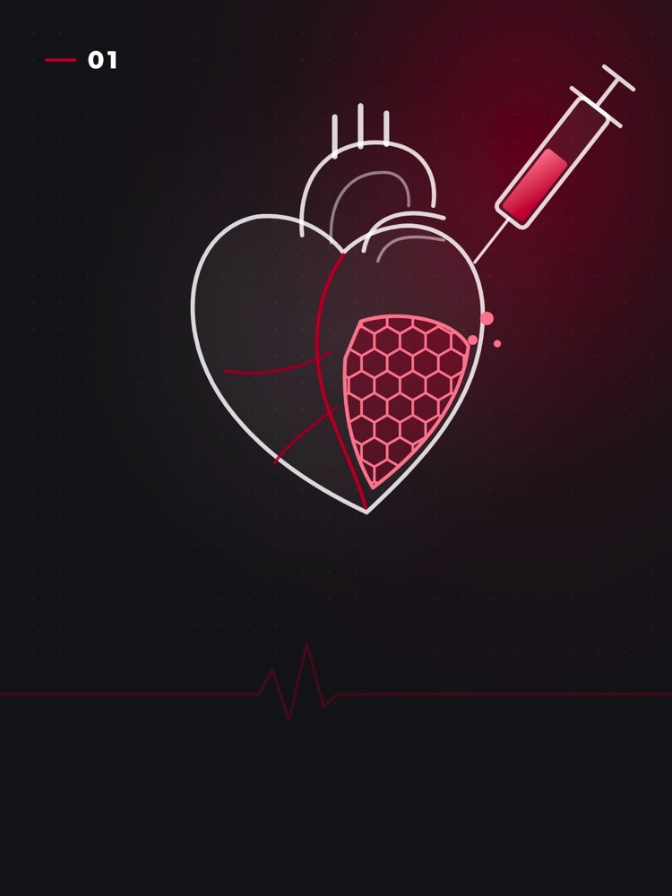 Biomaterials for Heart Repair